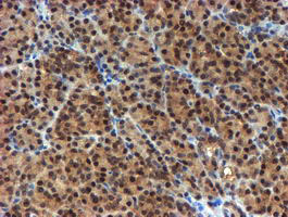 NQO2 Antibody in Immunohistochemistry (Paraffin) (IHC (P))