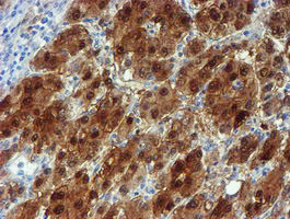 NQO2 Antibody in Immunohistochemistry (Paraffin) (IHC (P))