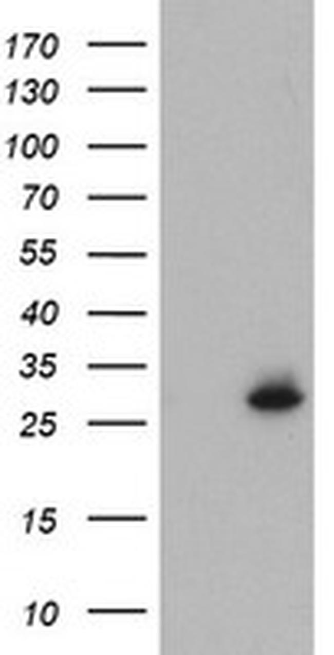 NQO2 Antibody in Western Blot (WB)