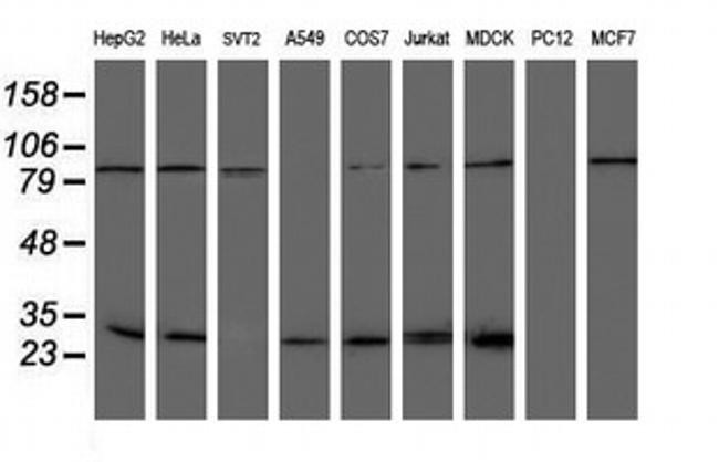 NQO2 Antibody in Western Blot (WB)