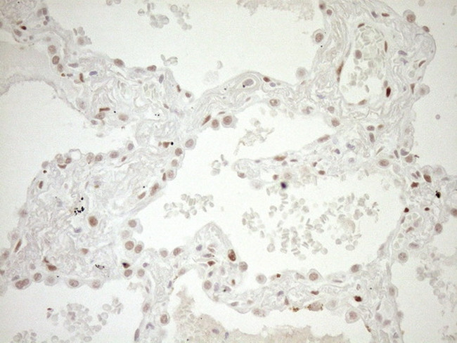 NR1H3 Antibody in Immunohistochemistry (Paraffin) (IHC (P))