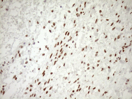 NR1H3 Antibody in Immunohistochemistry (Paraffin) (IHC (P))