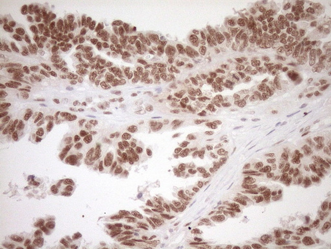 NR1H3 Antibody in Immunohistochemistry (Paraffin) (IHC (P))