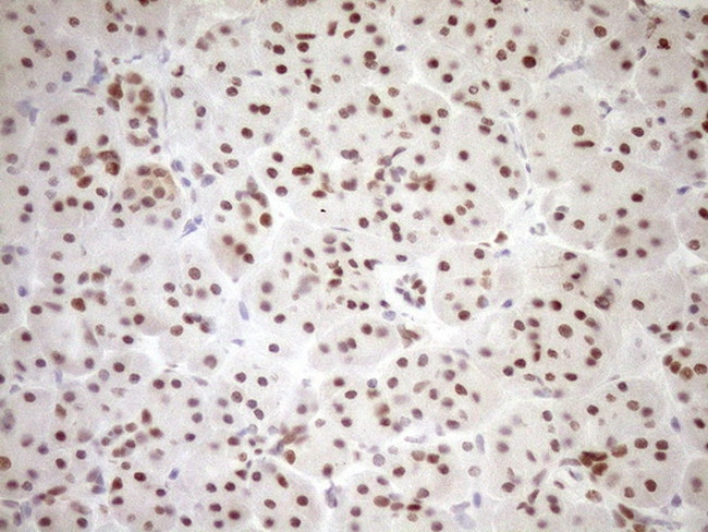 NR1H3 Antibody in Immunohistochemistry (Paraffin) (IHC (P))