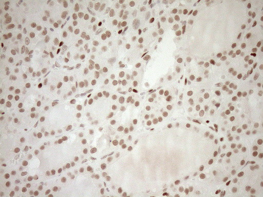 NR1H3 Antibody in Immunohistochemistry (Paraffin) (IHC (P))