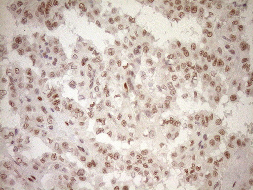 NR1H3 Antibody in Immunohistochemistry (Paraffin) (IHC (P))