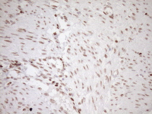 NR1H3 Antibody in Immunohistochemistry (Paraffin) (IHC (P))