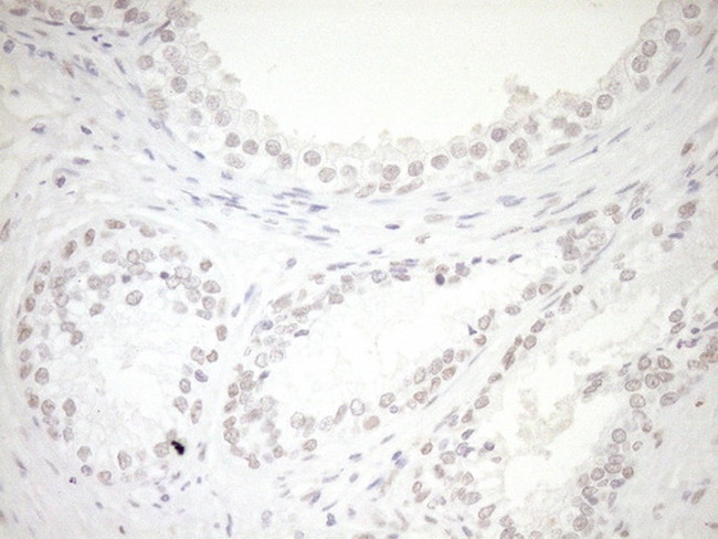 NR1H3 Antibody in Immunohistochemistry (Paraffin) (IHC (P))