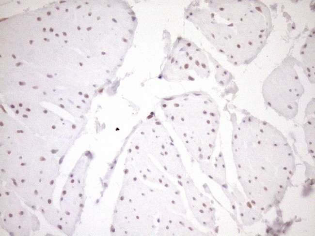 NR1H3 Antibody in Immunohistochemistry (Paraffin) (IHC (P))