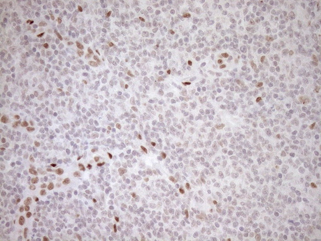 NR1H3 Antibody in Immunohistochemistry (Paraffin) (IHC (P))