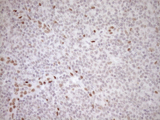 NR1H3 Antibody in Immunohistochemistry (Paraffin) (IHC (P))