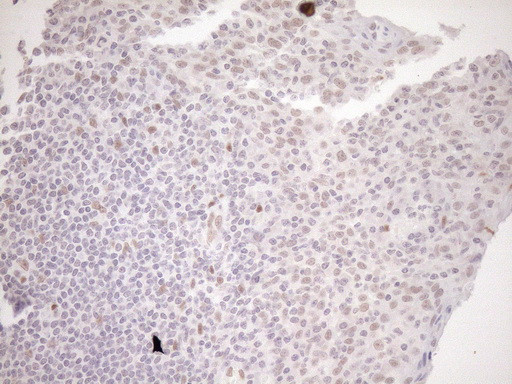 NR1H3 Antibody in Immunohistochemistry (Paraffin) (IHC (P))