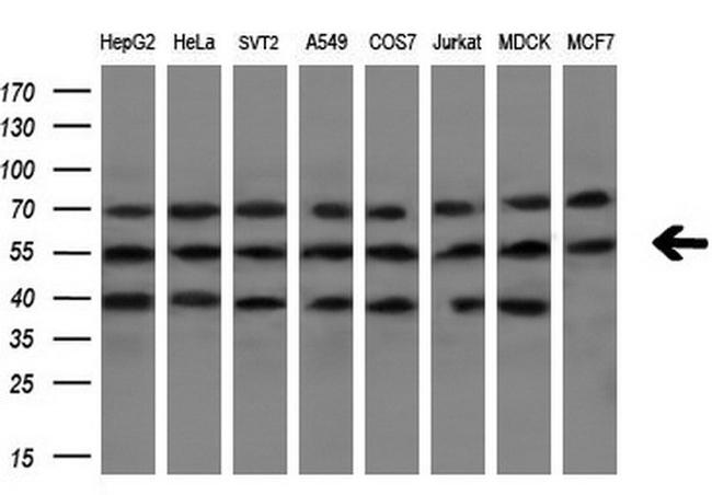 NR1H3 Antibody in Western Blot (WB)