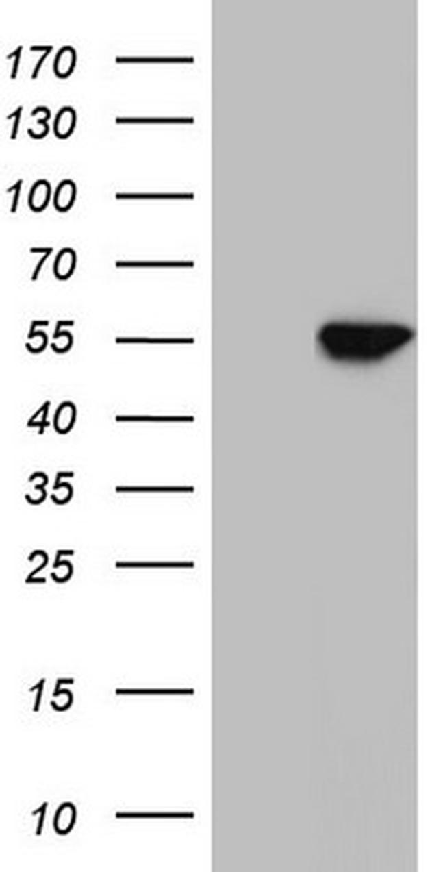 NR1H3 Antibody in Western Blot (WB)