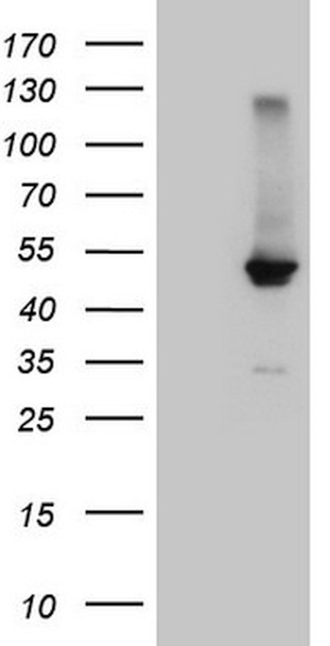 NR1H4 Antibody in Western Blot (WB)