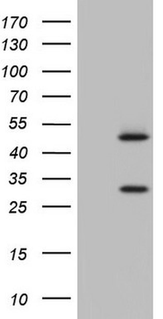 NR1I3 Antibody in Western Blot (WB)