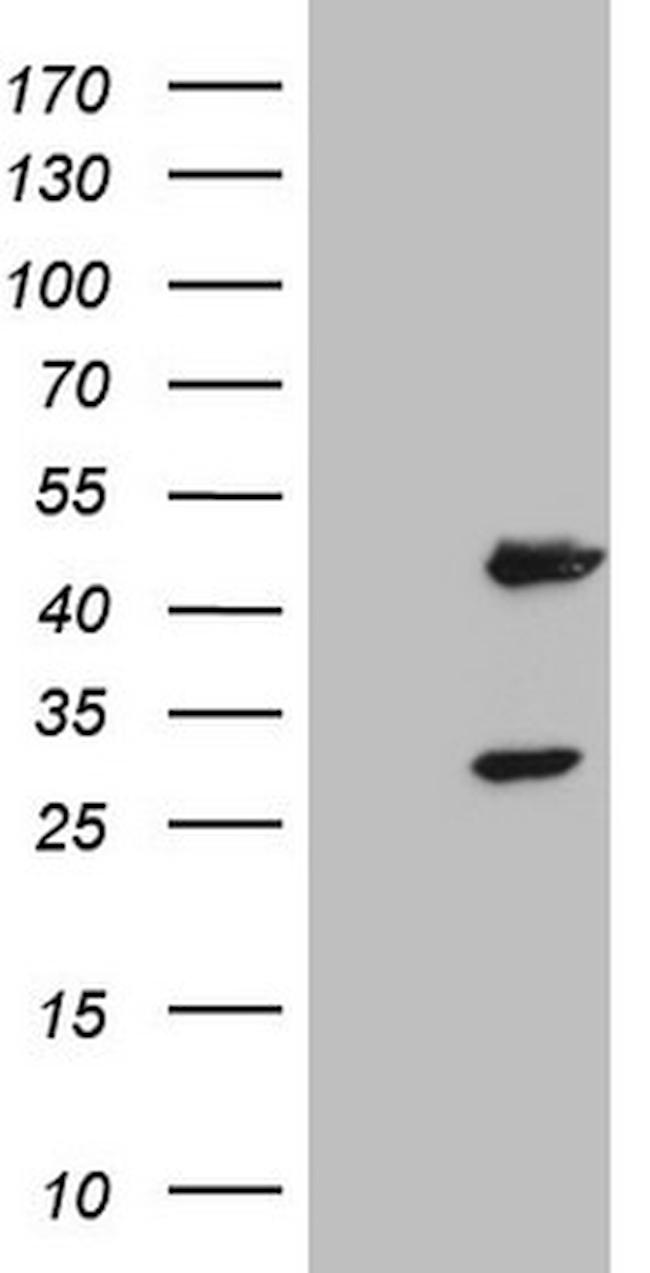 NR1I3 Antibody in Western Blot (WB)