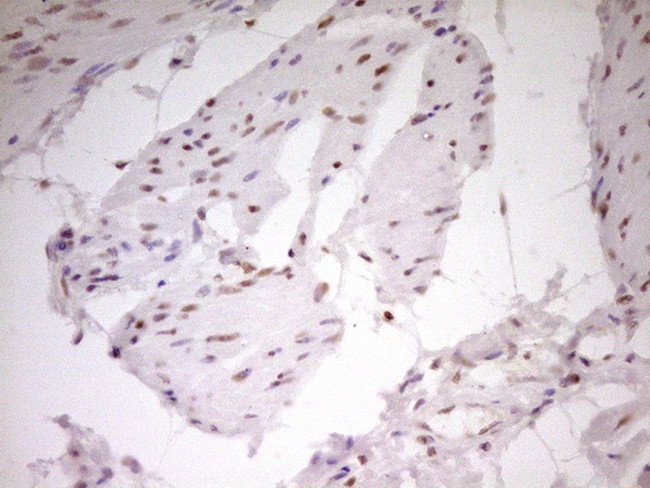 NR2C2 Antibody in Immunohistochemistry (Paraffin) (IHC (P))