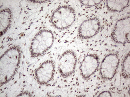 NR2C2 Antibody in Immunohistochemistry (Paraffin) (IHC (P))