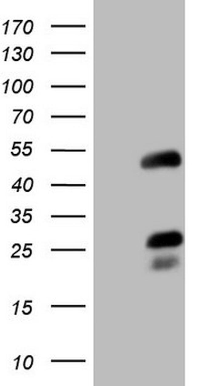 NR2F6 Antibody in Western Blot (WB)