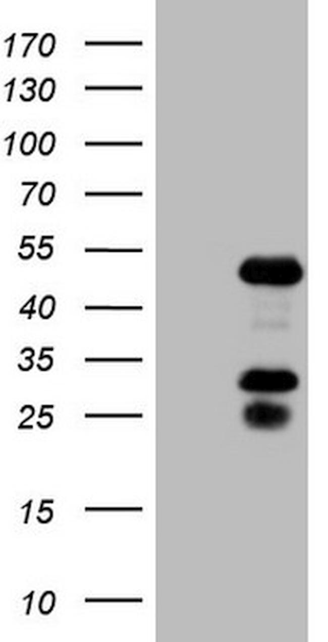 NR2F6 Antibody in Western Blot (WB)