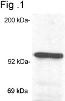 Glucocorticoid Receptor Antibody in Western Blot (WB)