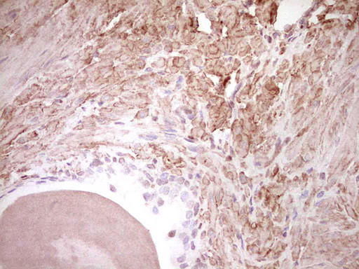 NR3C1 Antibody in Immunohistochemistry (Paraffin) (IHC (P))