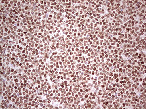 NR3C1 Antibody in Immunohistochemistry (Paraffin) (IHC (P))