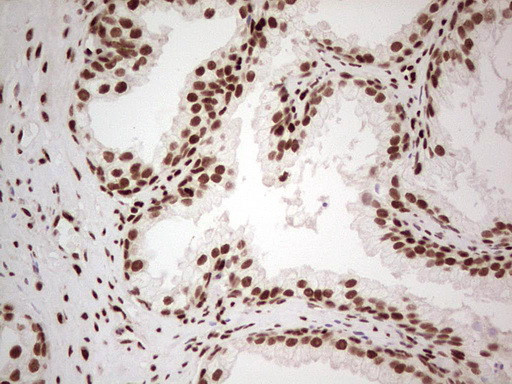 NR3C1 Antibody in Immunohistochemistry (Paraffin) (IHC (P))