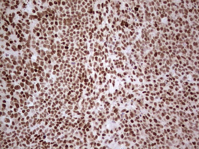 NR3C1 Antibody in Immunohistochemistry (Paraffin) (IHC (P))