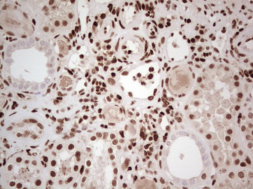 NR3C1 Antibody in Immunohistochemistry (Paraffin) (IHC (P))