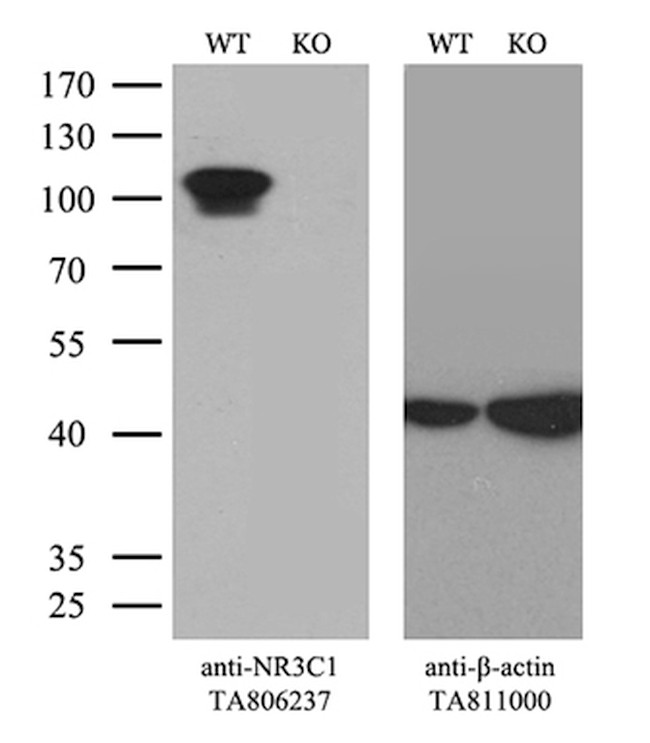 NR3C1 Antibody