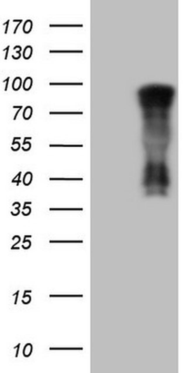 NR3C1 Antibody in Western Blot (WB)