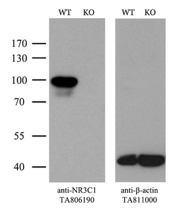 NR3C1 Antibody in Western Blot (WB)