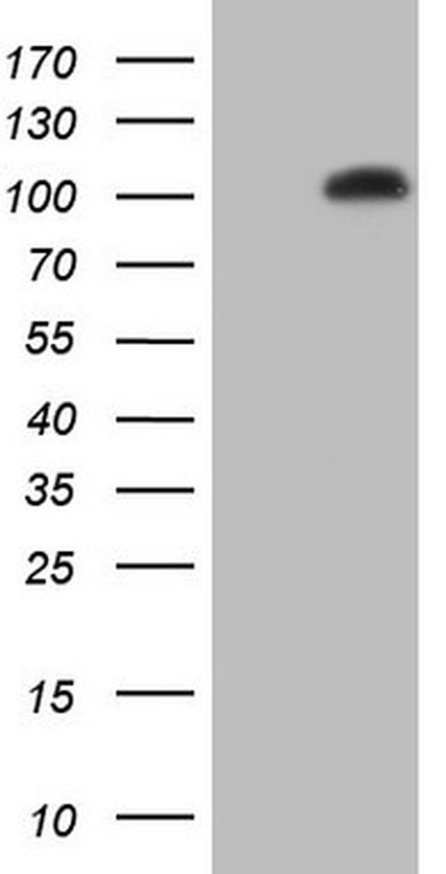 NR3C1 Antibody in Western Blot (WB)