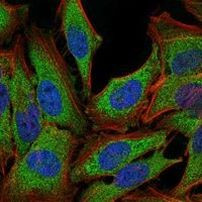 Glucocorticoid Receptor Antibody in Immunocytochemistry (ICC/IF)