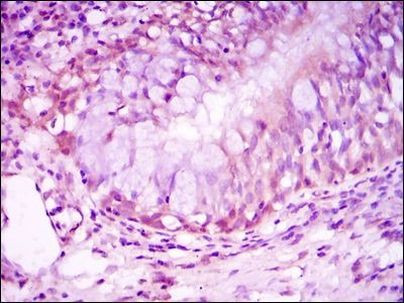 Glucocorticoid Receptor Antibody in Immunohistochemistry (Paraffin) (IHC (P))