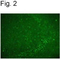 Nurr1 Antibody in Immunohistochemistry (IHC)