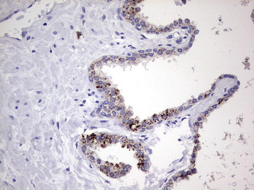 NR4A3 Antibody in Immunohistochemistry (Paraffin) (IHC (P))