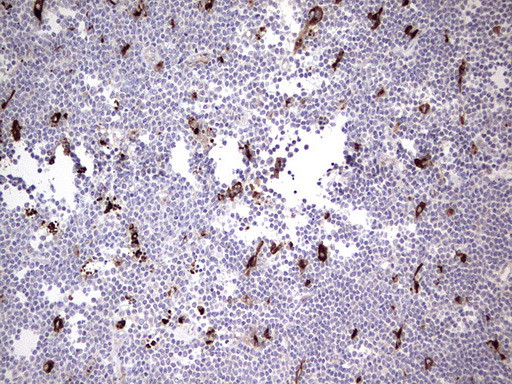 NR4A3 Antibody in Immunohistochemistry (Paraffin) (IHC (P))