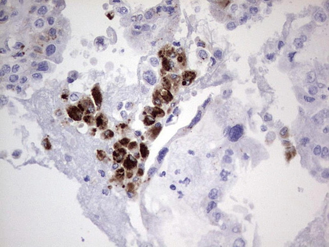 NR4A3 Antibody in Immunohistochemistry (Paraffin) (IHC (P))