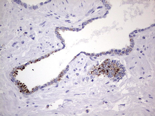 NR4A3 Antibody in Immunohistochemistry (Paraffin) (IHC (P))