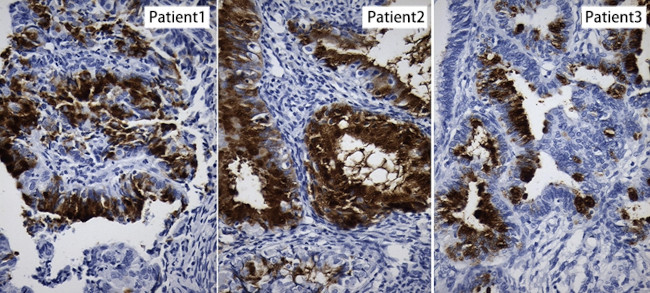 NR5A1 Antibody in Immunohistochemistry (Paraffin) (IHC (P))