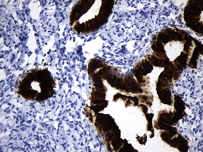 NR5A1 Antibody in Immunohistochemistry (Paraffin) (IHC (P))