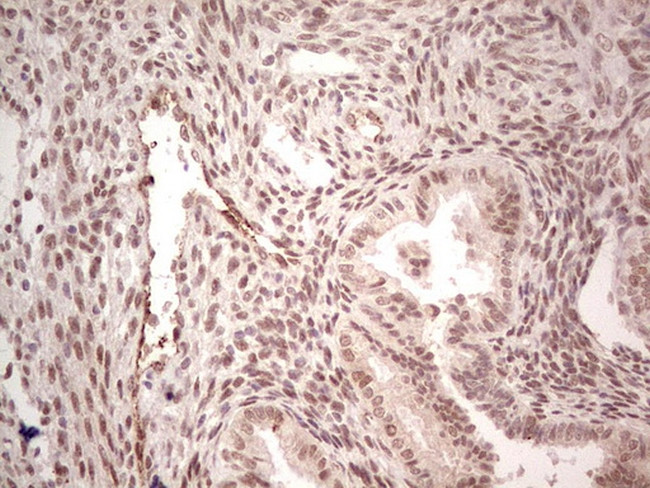 NR5A1 Antibody in Immunohistochemistry (Paraffin) (IHC (P))