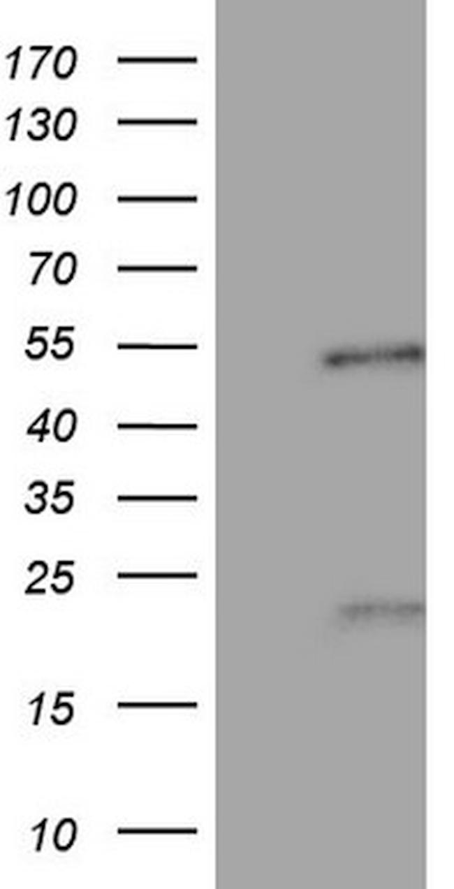 NR5A1 Antibody in Western Blot (WB)