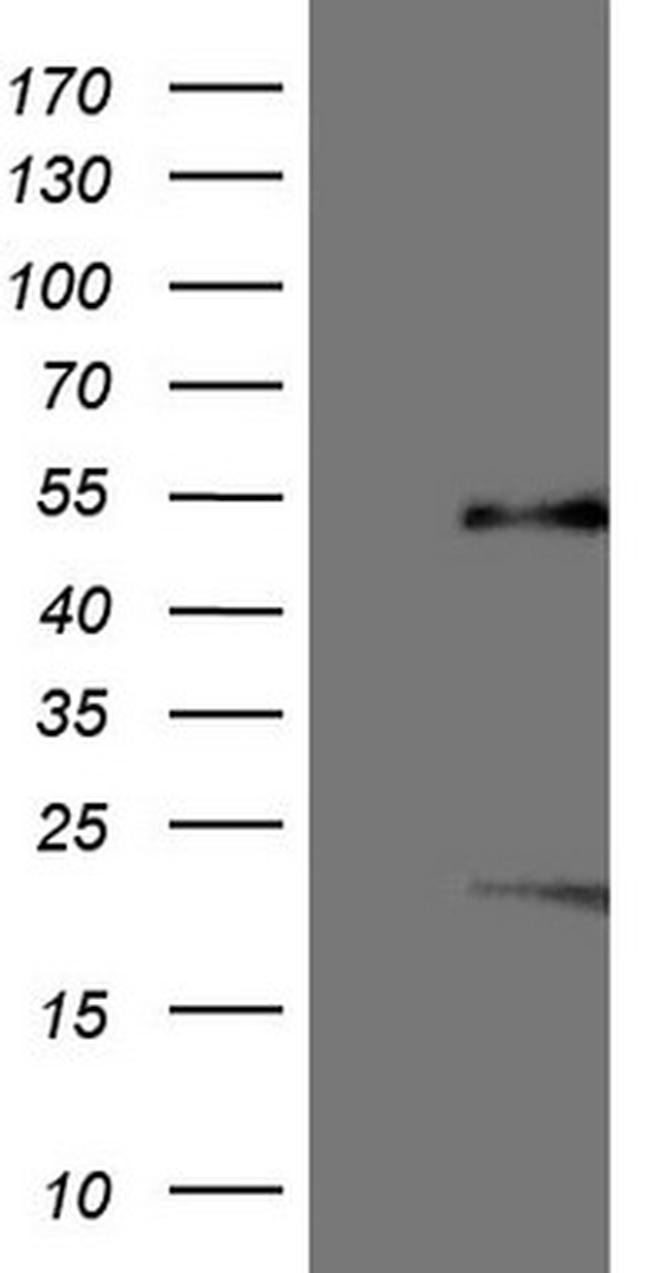 NR5A1 Antibody in Western Blot (WB)