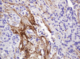 NRAS Antibody in Immunohistochemistry (Paraffin) (IHC (P))