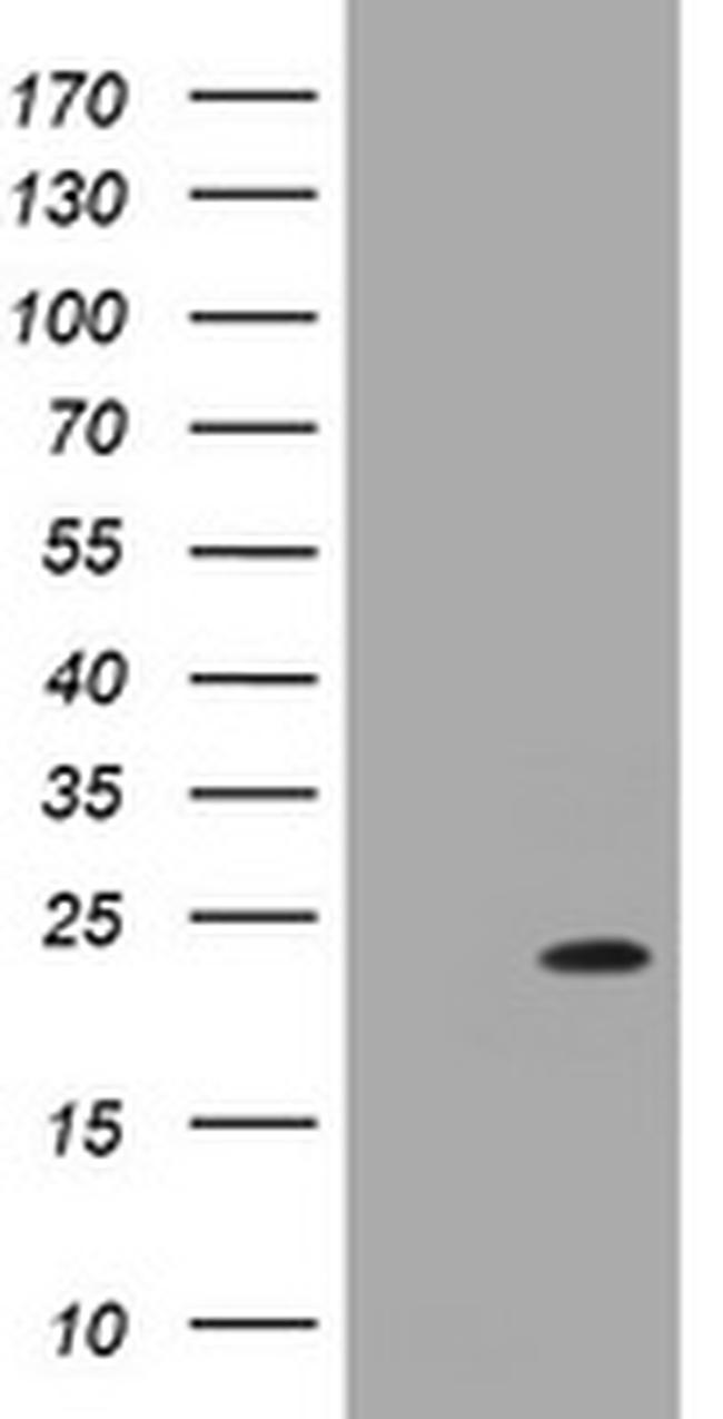 NRAS Antibody in Western Blot (WB)