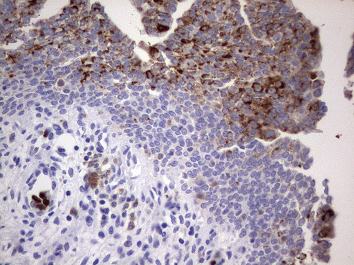 NRBF2 Antibody in Immunohistochemistry (Paraffin) (IHC (P))